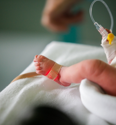 Baby With Drip In Foot