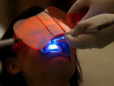 Teeth Whitening Editorial Only