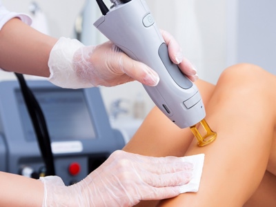 Laser Hair Removal On Legsjpeg