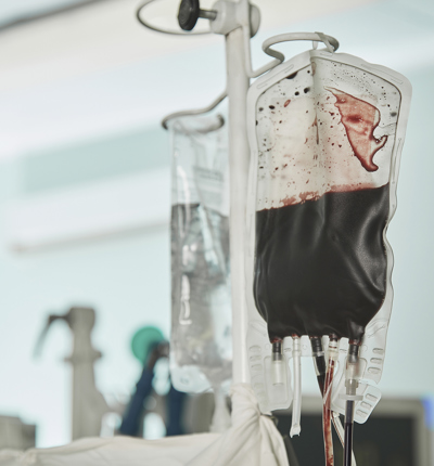 Blood Transfusion