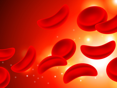 Sickle Cell