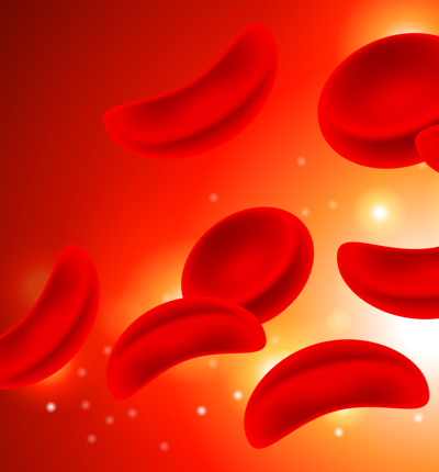 Sickle Cell