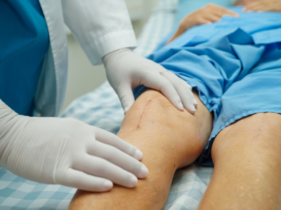 Knee Replacement
