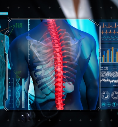 Xray Of Spine